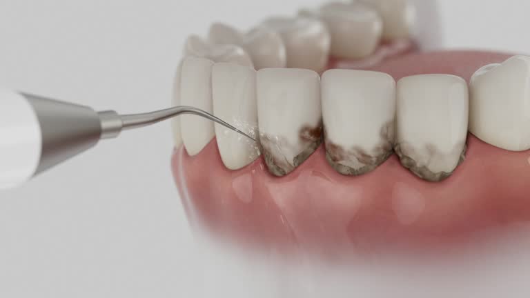 Reliable Tooth Extraction contractor in Altamont, KS by Smile Center Dentistry